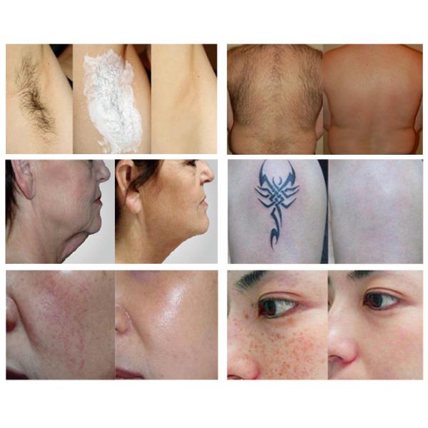 Colour Laser Multifunction IPL RF Beauty Equipment 2500W 44*53*89cm Size