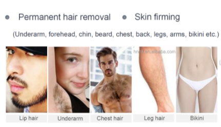 808Nm Diode Laser Hair Removal Machine Depilator Ipl Laser Equipment