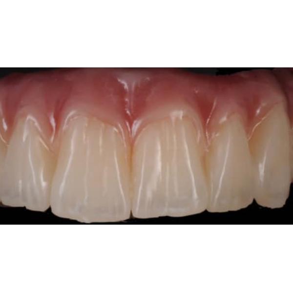 16 Vita Shades Multilayer 3D Pro Zirconia Disc Dental For Anterior Posterior