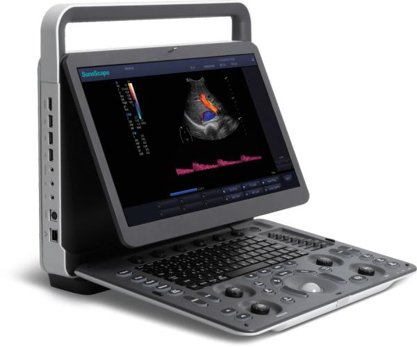 15.6'' LCD Sonoscape E2 Ultrasound Machine With 2 Year Warranty