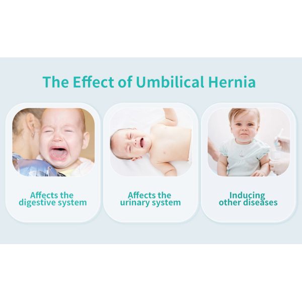 Skin Friendly Breathable Clear Wound Dressings for Baby's Navel Neonatal Hip Hernia