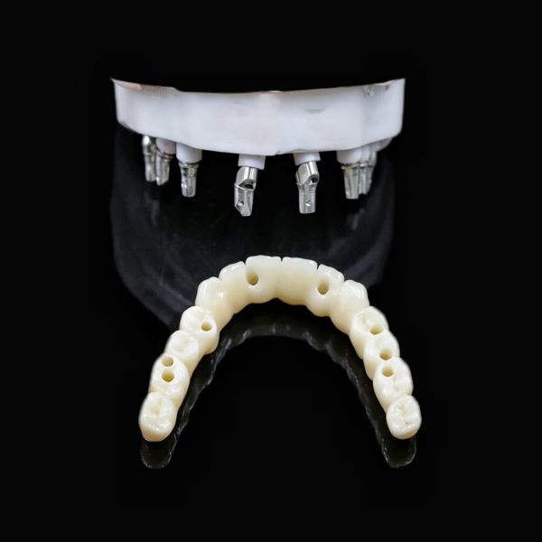 Durable Biocompatible Artificial Tooth Root Implant Suitable for Dental Restoration Procedures and Long Term Stability