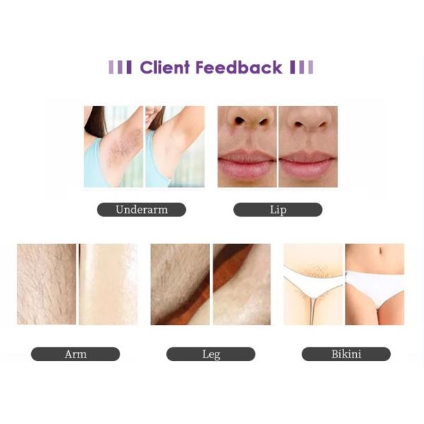 Máquina 500w 1600w del retiro del pelo del diodo láser de 808 nanómetro Yag para la cara y el cuerpo