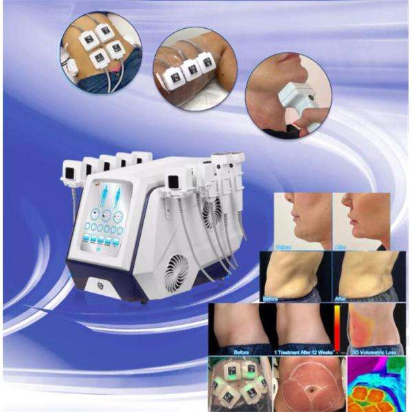 Monopolar тело Trusculpt 3d оборудования красоты Rf уменьшая сало уменьшает 5MHz