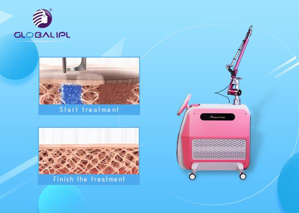 Pico Laser ND YAG Laser Machine Tattoo Removal Skin Therapy 1064nm / 532nm