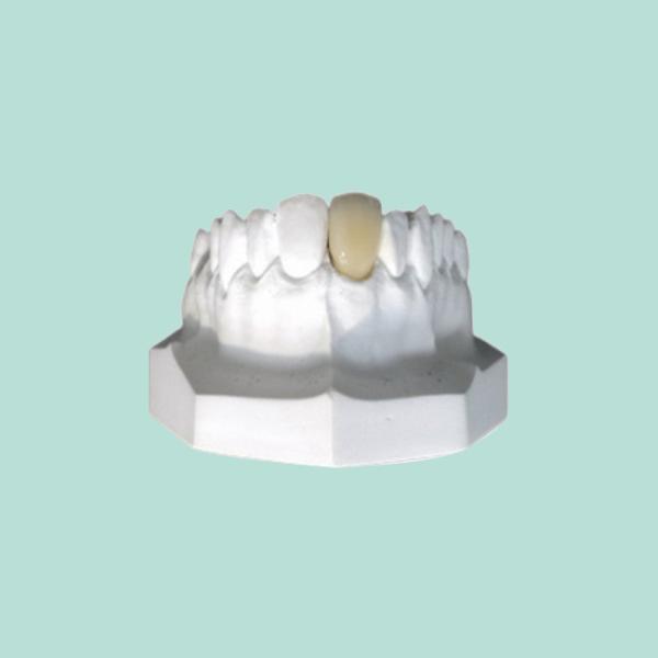 Las coronas modificadas para requisitos particulares de la porcelana tienen un aspecto real y un color natural