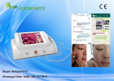 RBS high frequency 30MHZ thermal coagulation vascular spider vein removal machine