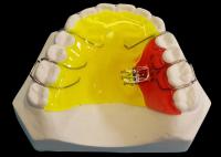 Appareils orthodontiques amovibles à trois directions pour les besoins des clients à des prix compétitifs