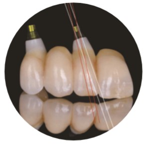 Natural ASC Angled Screw Channel Dental Implants Crown