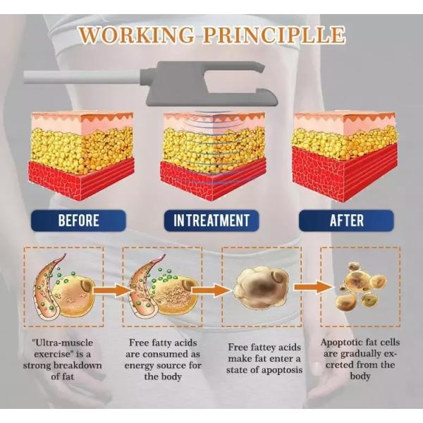 Аппарат для укрепления мышц и подтяжки ягодиц Hiemt Ems с 4 манипулами, 7 Тесла, для похудения и коррекции фигуры