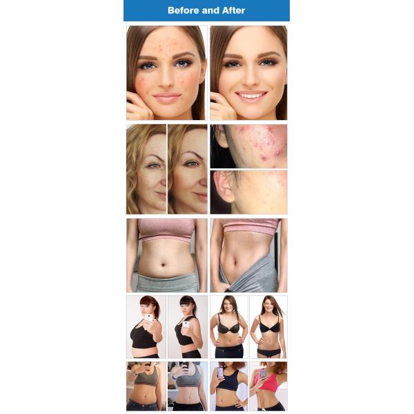 448K máquina de escultura de grasa máquina de cavitación para relajación posparto