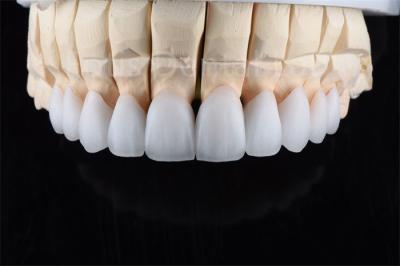 Crack Resistance Zirconia Multilayer Ceramic Ultimate Solution For Industrial Efficiency