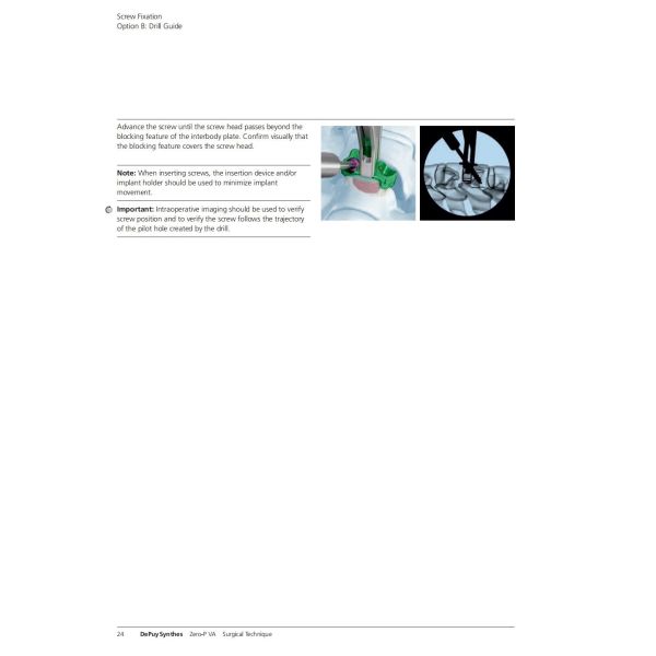 Sterilization 2 Screws Zero Profile Cage Anterior Cervical Cage Stand Alone CE Spinal Surgery