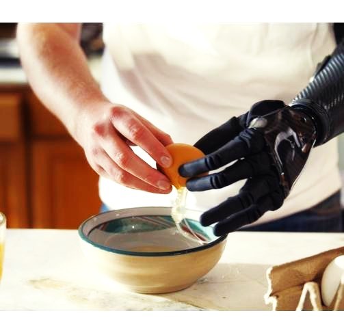 PSYONIC Ability Hand 31 Grips Multi-Finger Bionic Hand Fast Closing Myoelectric Control Prosthetic Hand