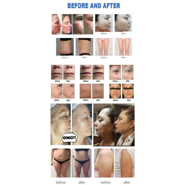 12 линии уменьшение тела морщинки прибора ультразвука высокой интенсивности сфокусированное анти-