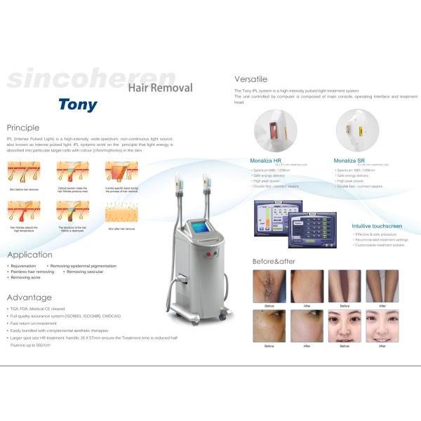 FDA approved SHR IPL ELOS hair removal,skin rejuvenation system permanently hair removal