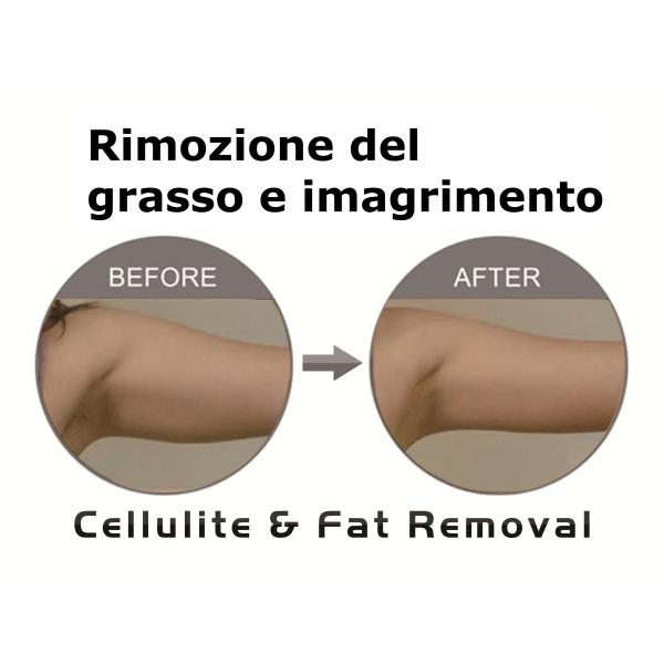 Portable Cryolipolysis Slimming Machine , Body Fat Freezing Machine