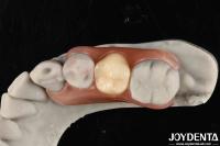 Révolutionnez votre cadre de pratique dentaire, mettez en place des finitions dentaires avec une technologie élaborée de la dentisterie.