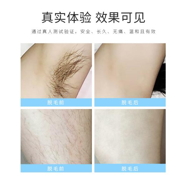White Home Permanent Hair Removal System Laser Hair Removal Small Machine
