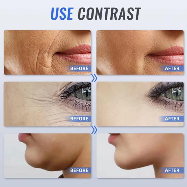 Mini Handheld Hifu Machine For Wrinkle Whitening Firming Skin Rejuvenation