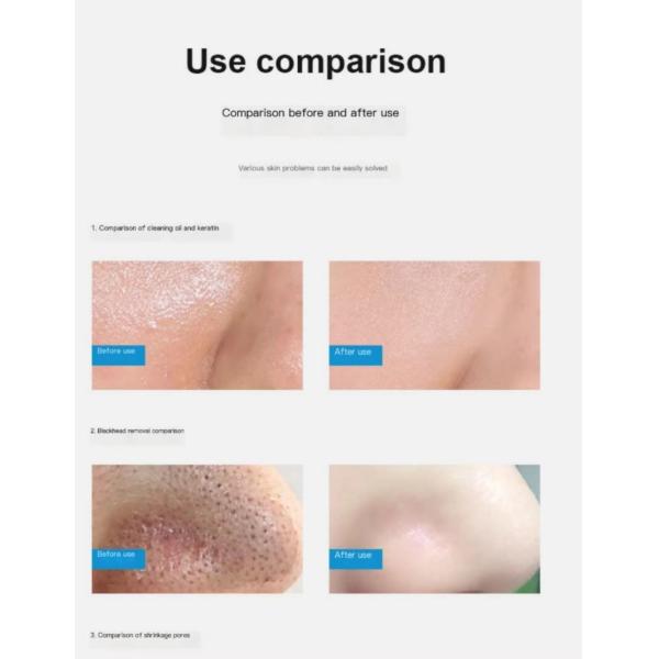 Aqua кожи машины красоты гидры перевозчика угорь лицевой глубоко очищая 14 в 1