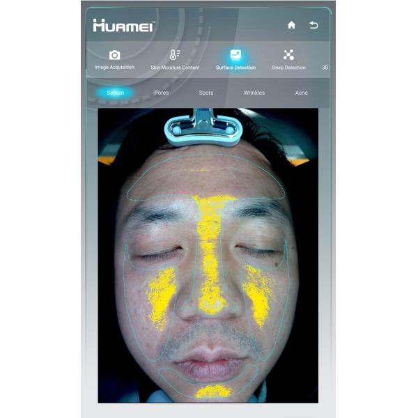 EU Plugs Portable Wifi Ipad Version 3d Skin Scanner Analyzer for Allergic Skin Test