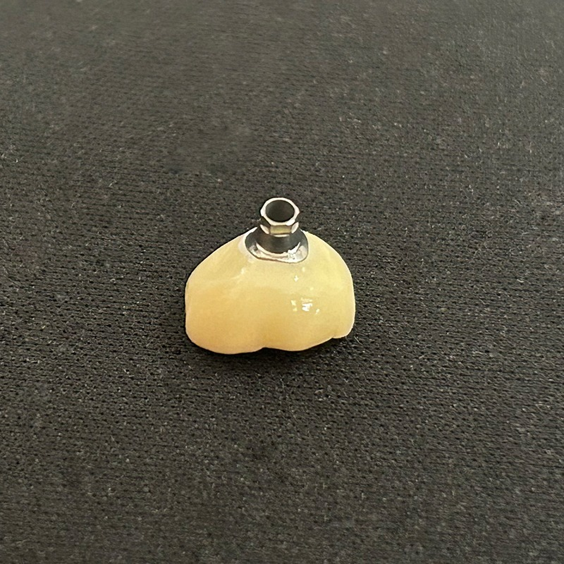 Zirconia or Pfm Dental Implant Screw Retained Crown and Bridge