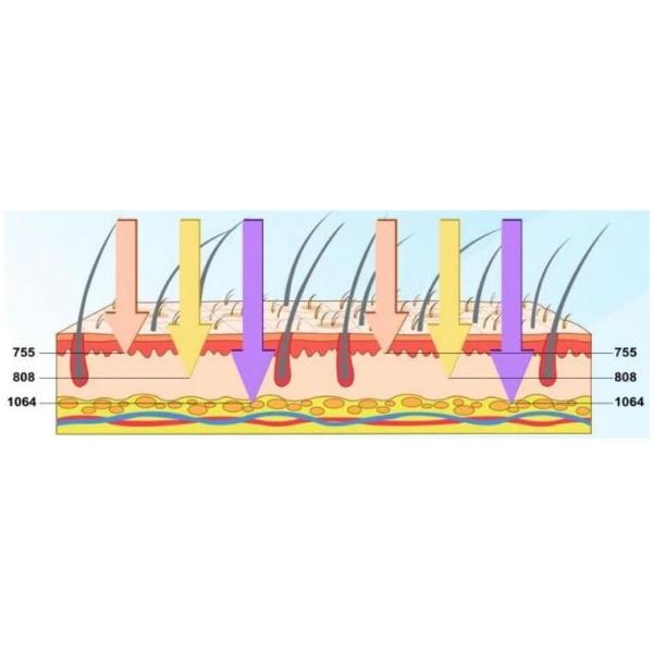 Newest design 755/808/1064nm combination diode laser hair removal machine