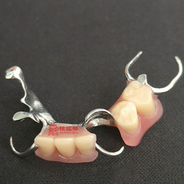3D Printing Co Cr Alloy Removable Denture Framework With Acrylic Teeth