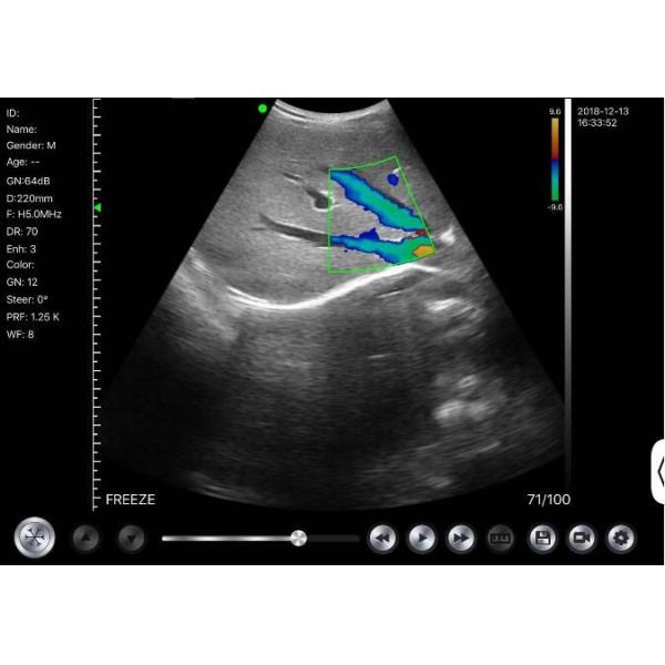 Применение педиатрии Gynecology домашнего ультразвука Doppler ультразвука Doppler портативного диагностического ручного акушерское