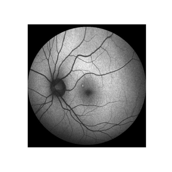 Equipo oftálmico de Angiograph Digital 160° de la retina