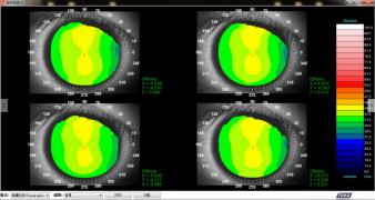 CT-6 China Ophthalmic equipment Corneal Topography/Corneal topographer
