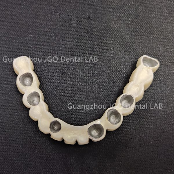 Pfm Teeth Crowns Porcelain Fused To Metal Cobalt Chrome Alloy
