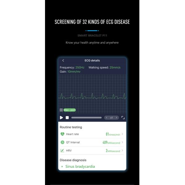 ЭКГ PPG Шагомер HR Монитор Смарт-браслет Фитнес-трекер Часы с кровяным давлением
