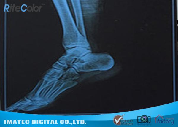Filme de impressão impermeável médico do Inkjet do filme de raio X do Inkjet azul da radiologia