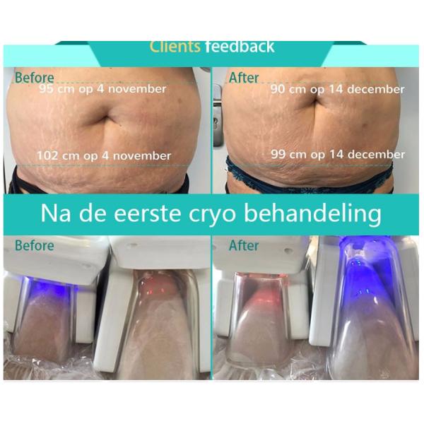 the most effective cryo slimming machine  paypal accepted Hot sale salon and clinic use best quality