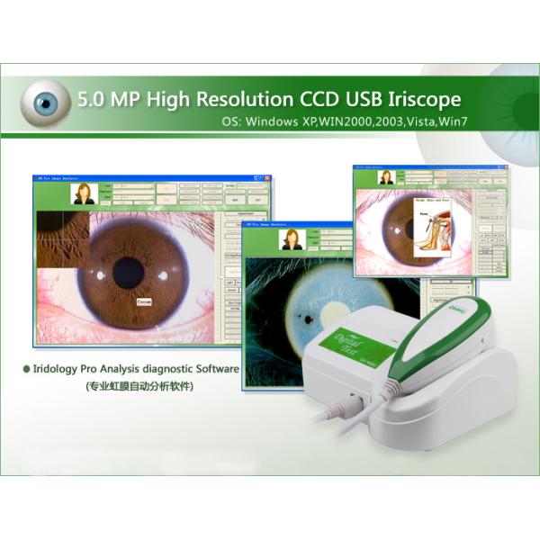 5,0 sistema de diagnóstico de alta resolución de análisis de imagen de la P.M. Iridology favorable