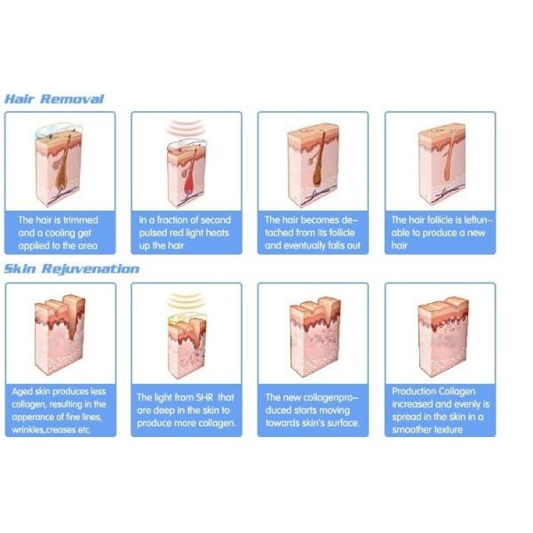 Multifunction 2000W E-light IPL RF Laser Hair Removal Machine , SHR IPL Machine