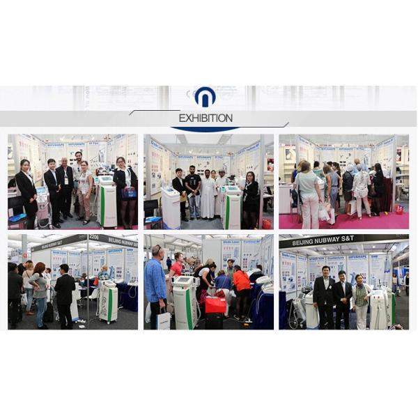 Factory Price Spider Vein Removal Machine / Veins Removal Machine / Facial Vein Removal