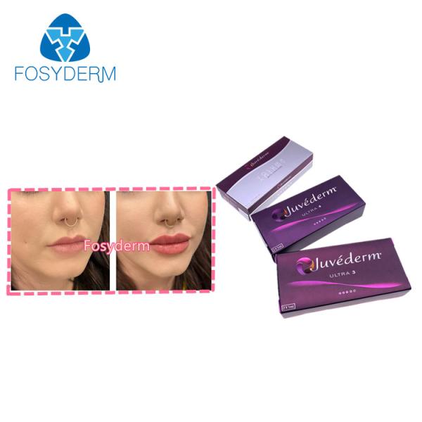 Injeção ácida hialurónica ligada dos enchimentos do bordo de Juvederm 2*1ml cruz cutânea para antienvelhecimento