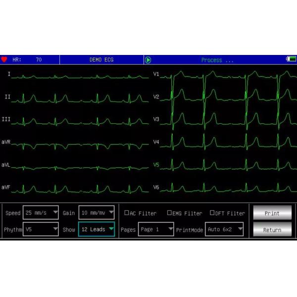 Electrocardiograph Portable Heart Monitor Manual 3 6 Channel Portable 12 Lead ECG Machine