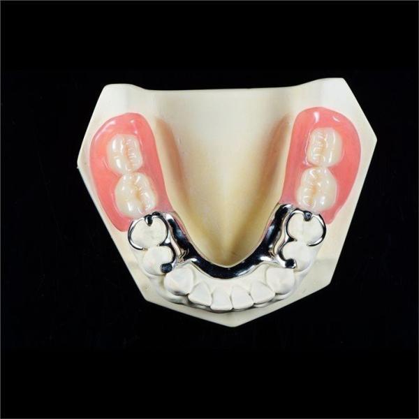 Co Cr Biocompatibile Metal Cast Framework Partial Dentures ODM