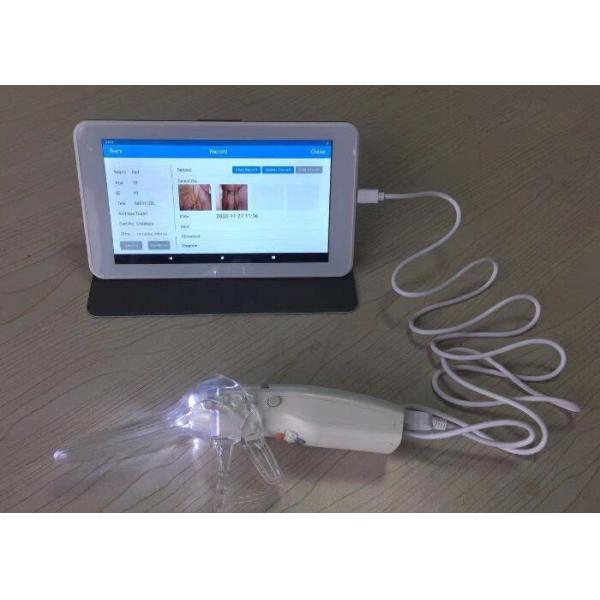 X Colposcope électronique de Digital de 1,5 rapports optiques se relient à la TV ou l'ordinateur ou le moniteur médical santé de s pour femmes '