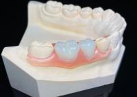 OEM Dentes invisibles extraíbles Prótesis dental parcial de resina acrílica a medida