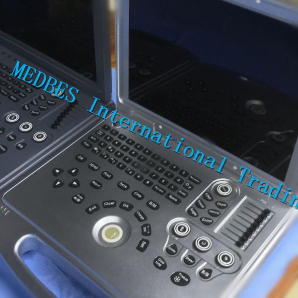 4D Baby Portable Medical Color Doppler Ultrasound Machine