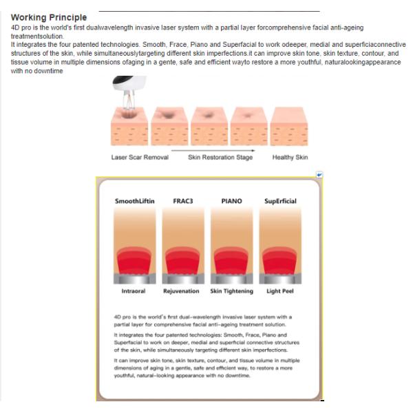 Factory Price Fotona 4D PRO 2940nm Erbium Laser +1064nm ND: YAG Laser Fotona 4D Er YAG Hair Removal