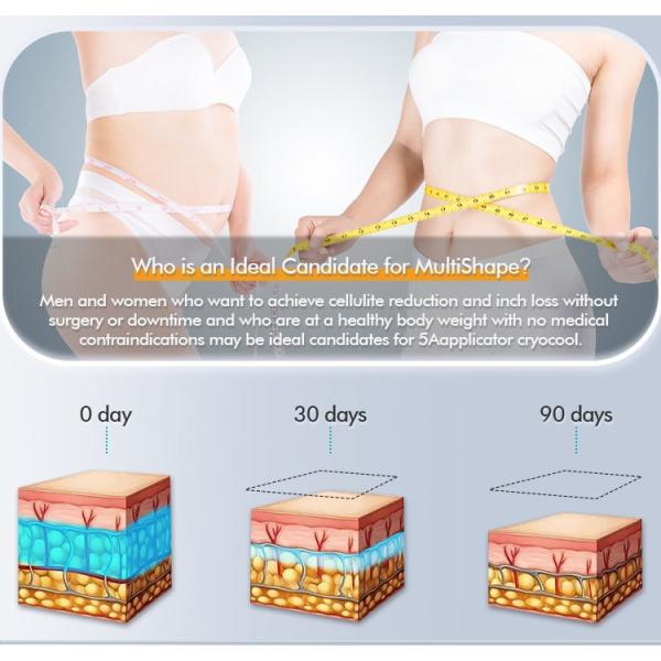 Новое жирное тело потери уменьшая холодную жирную замерзая красоту тела 360 градусов ваяя уменьшая машину