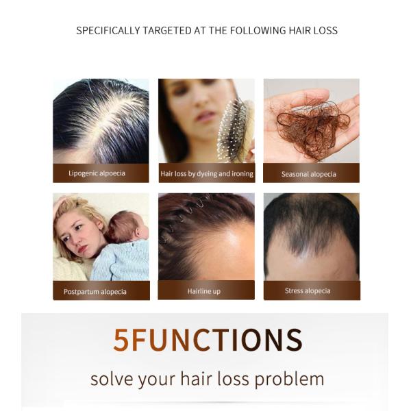 Волосы личной власти растут лазер чистят электрический гребень щеткой для обработки выпадения волос