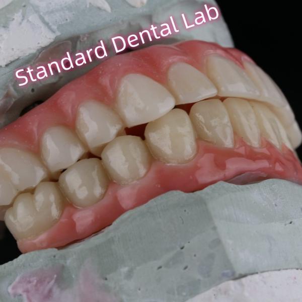 Puente de implantes dentales de porcelana de zirconia alta estética profesional con chicle rosa