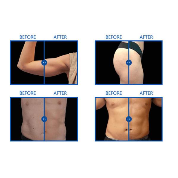 4 Handpieces Tesla EM Sculpting Machine Fat Loss Hiemt Muscle Machine